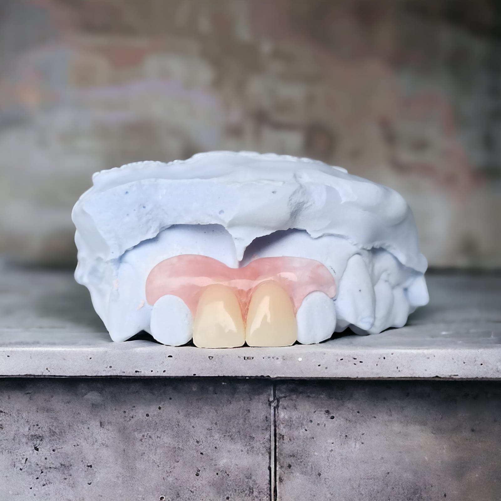 Dentures appliance and dental cast